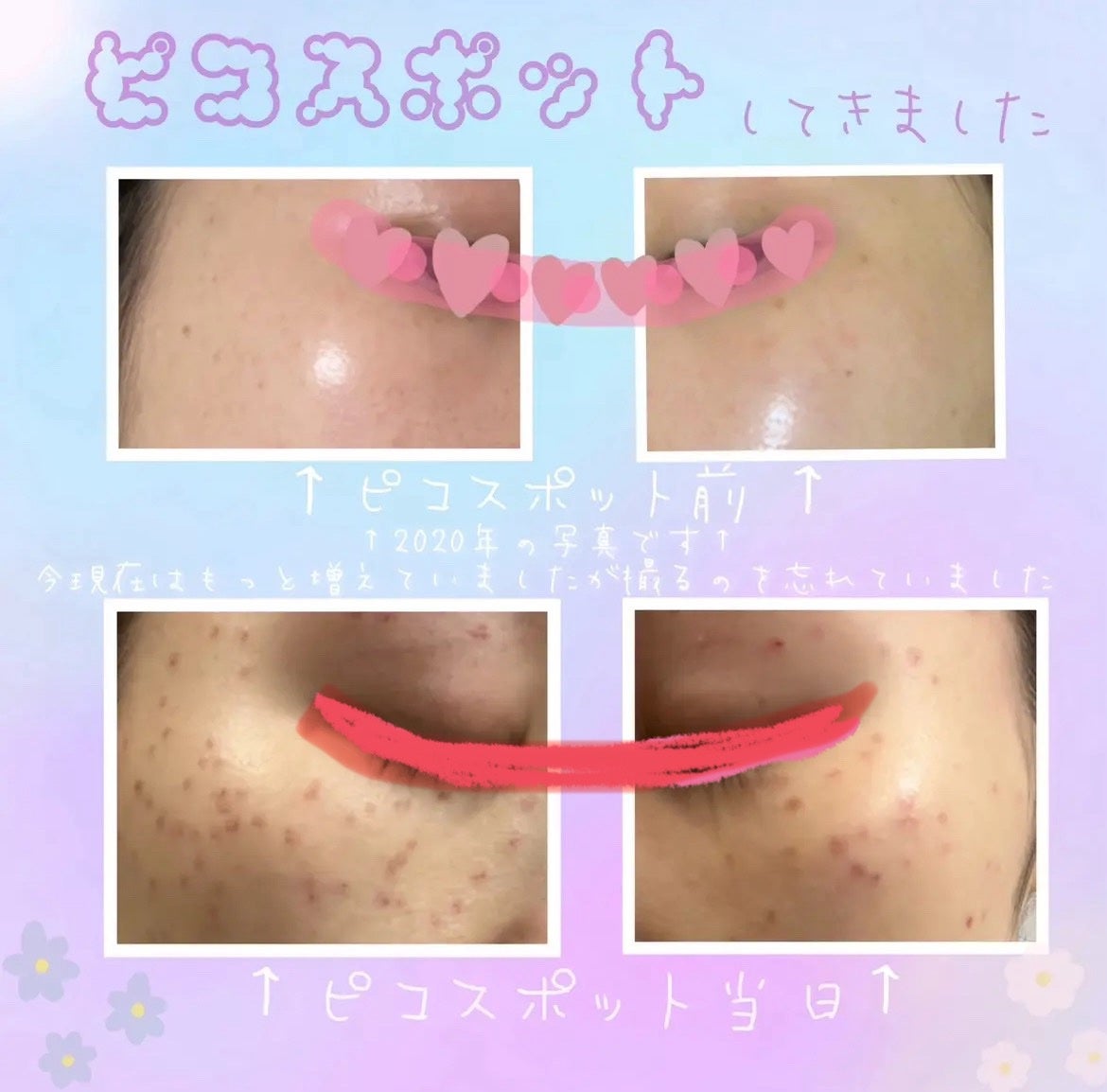 ミラミン/ZO Skin Health/フェイスクリームを使ったクチコミ(2枚目)