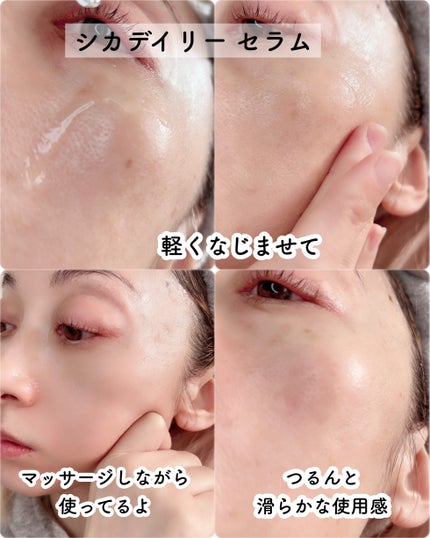 シカデイリー ジェルクリーム/ユリアージュ/フェイスクリームを使ったクチコミ(5枚目)