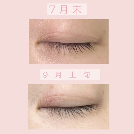 アイラッシュセラム プレミアムEX/ヒロインメイク/まつげ美容液を使ったクチコミ(2枚目)