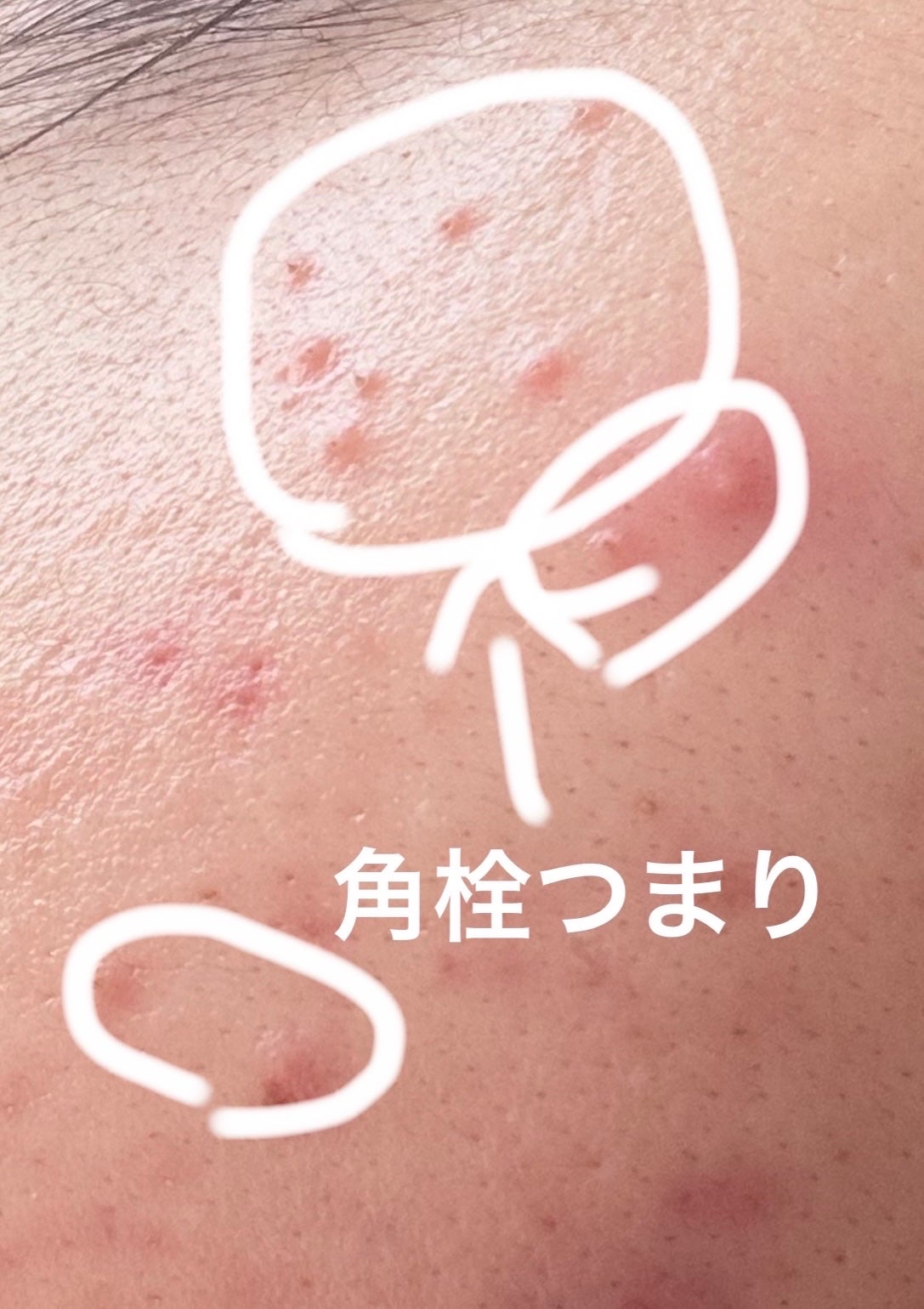 CICA カプセルマスク/VT/洗い流すパック・マスクを使ったクチコミ(2枚目)