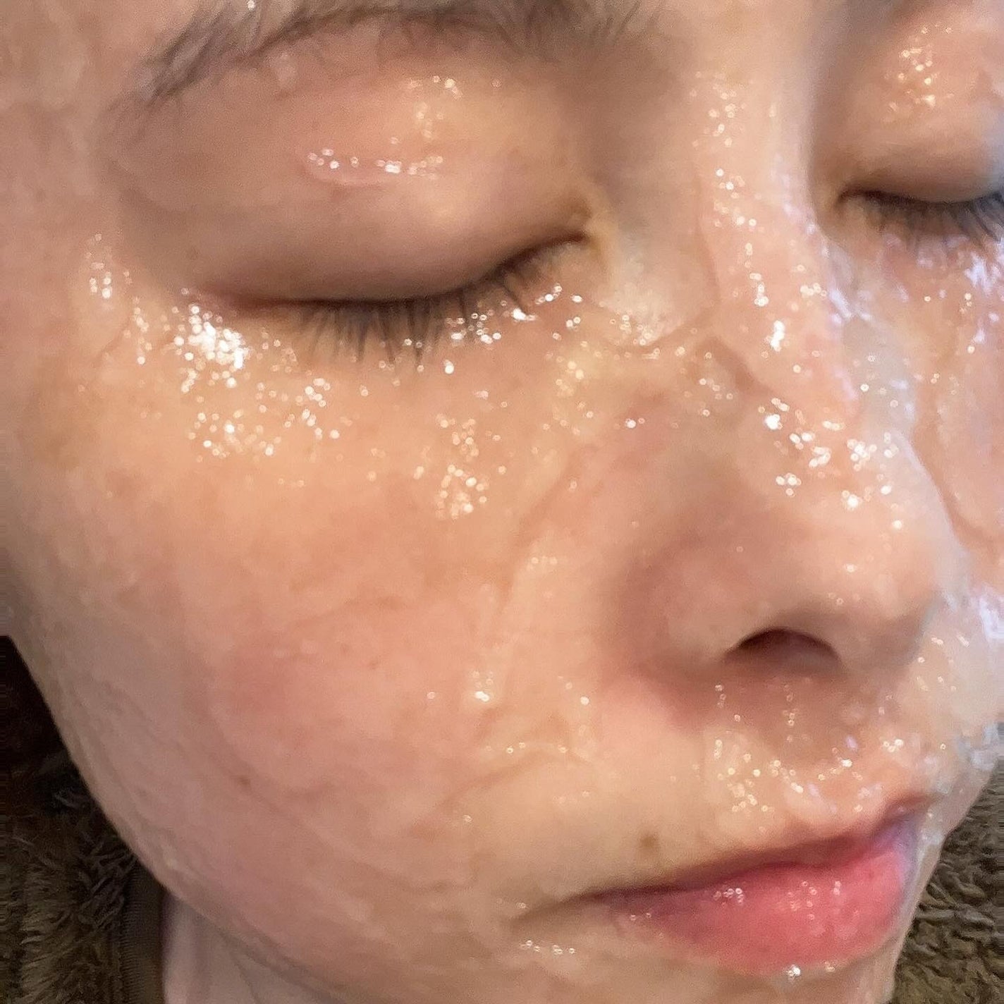 炭酸パックプレミアム/フェヴリナ/洗い流すパック・マスクを使ったクチコミ(5枚目)