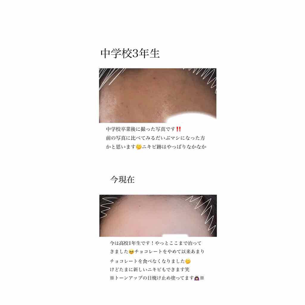 ビューティモイスチャー クリーミー泡洗顔料/ダヴ/泡洗顔を使ったクチコミ(4枚目)