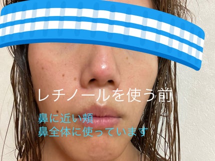 3番 集中ケアレチノール美容液/numbuzin/美容液を使ったクチコミ(2枚目)