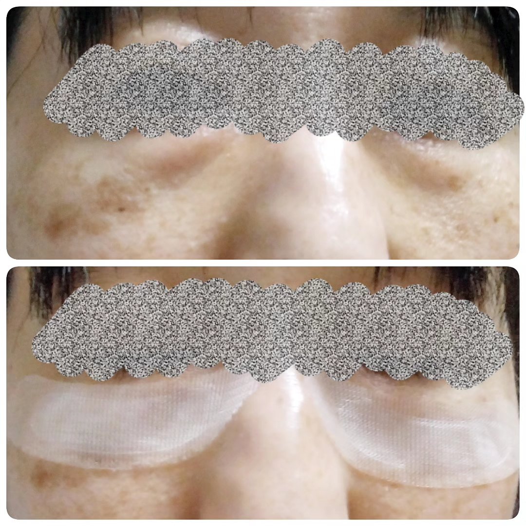 プロテオフィルパッチ/METLLASSE(メトラッセ)/シートマスク・パックを使ったクチコミ（3枚目）