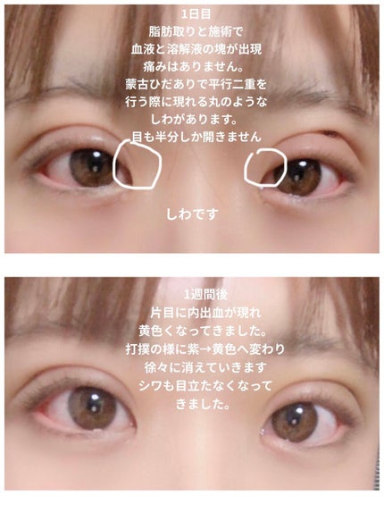 を使ったクチコミ(3枚目)