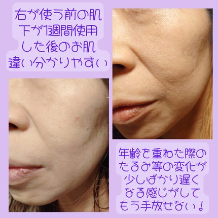 リードルショット100/VT/美容液を使ったクチコミ(4枚目)