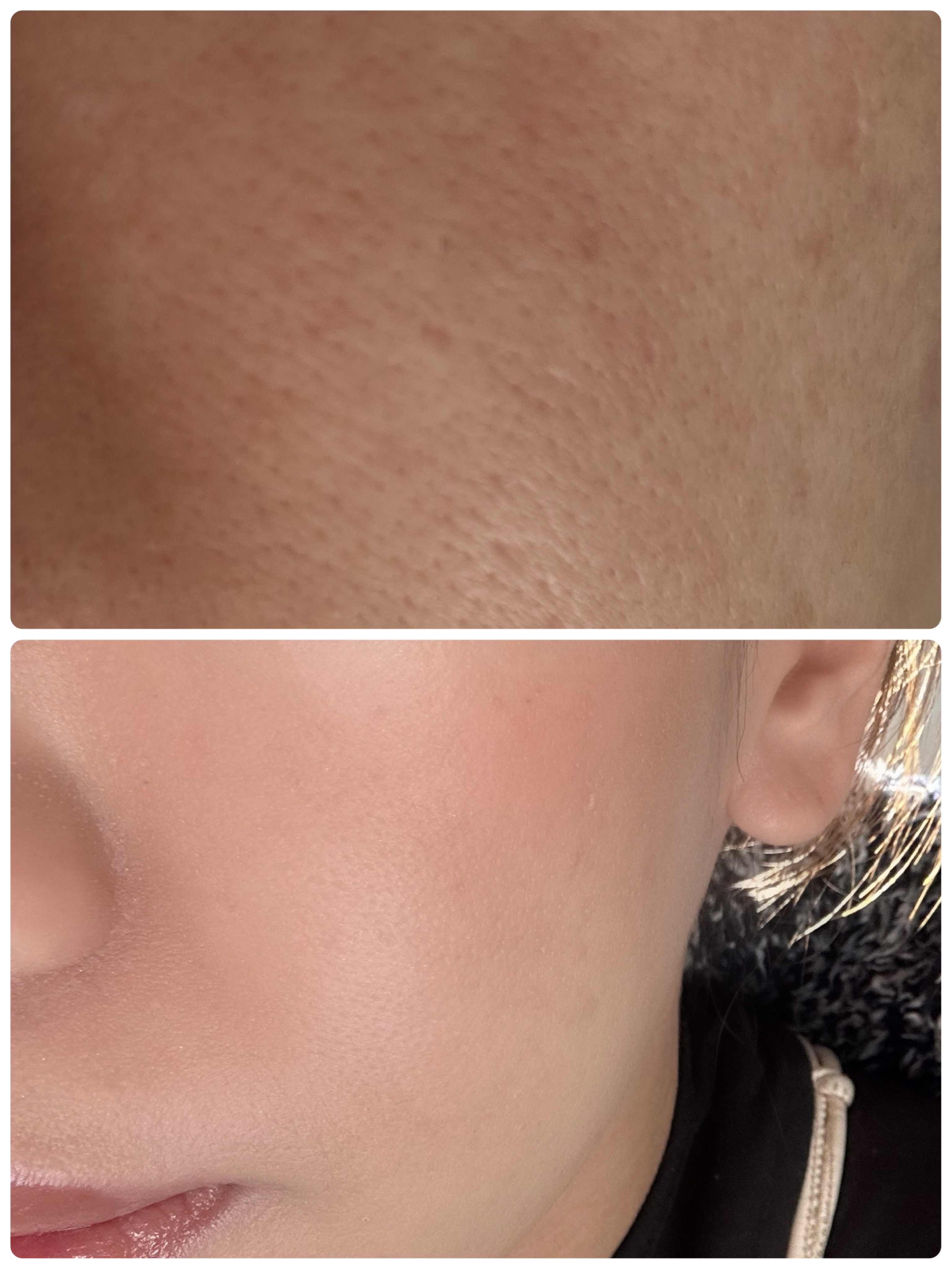 ルミナス シルク ファンデーション/ジョルジオ アルマーニ ビューティ/リキッドファンデーションを使ったクチコミ（1枚目）