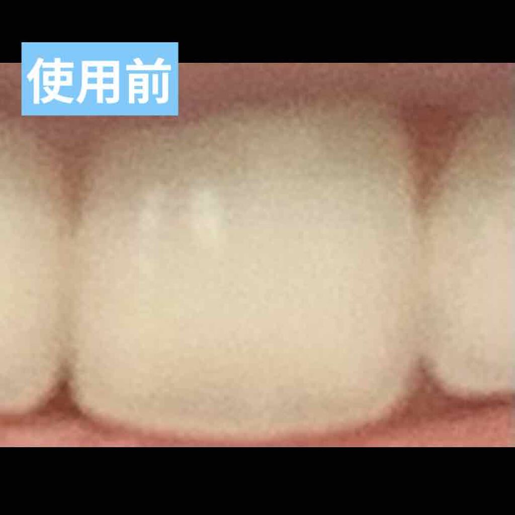 クレスト3Dホワイトニング ホワイトストリップ プロフェッショナル エフェクツ/クレスト/その他オーラルケアを使ったクチコミ（3枚目）