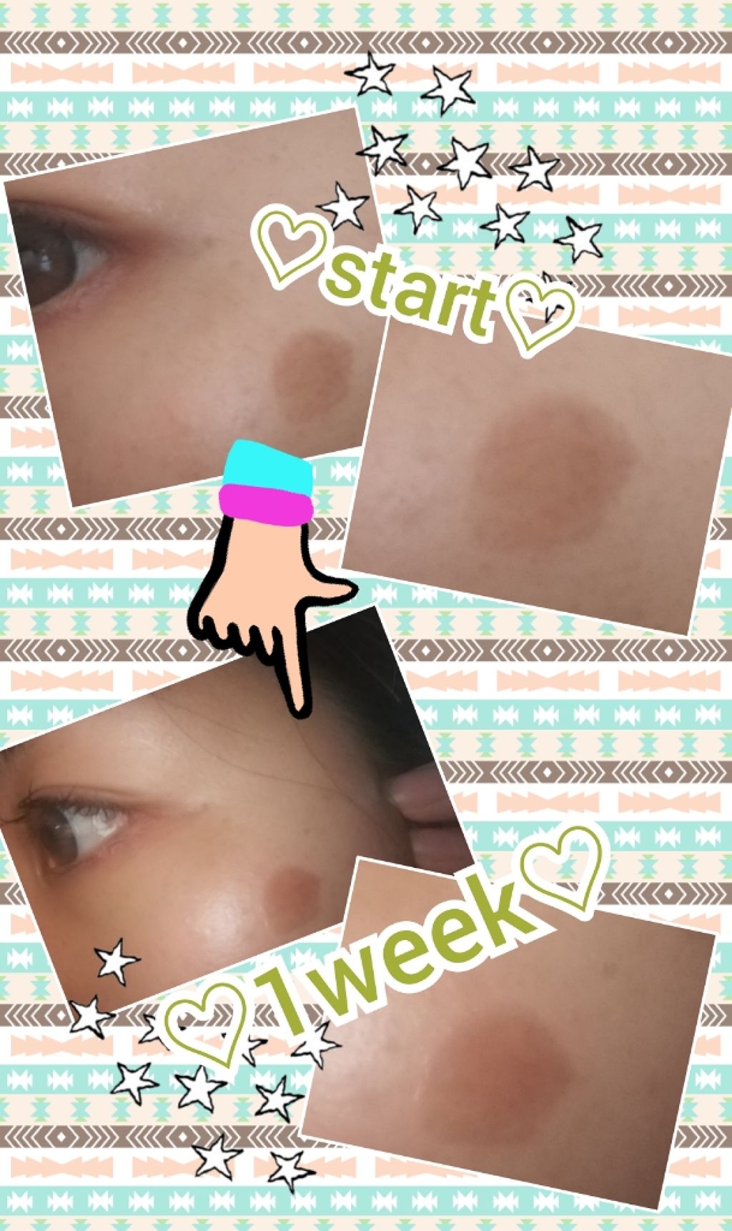 メラノフォーカスV/HAKU/美容液を使ったクチコミ(2枚目)