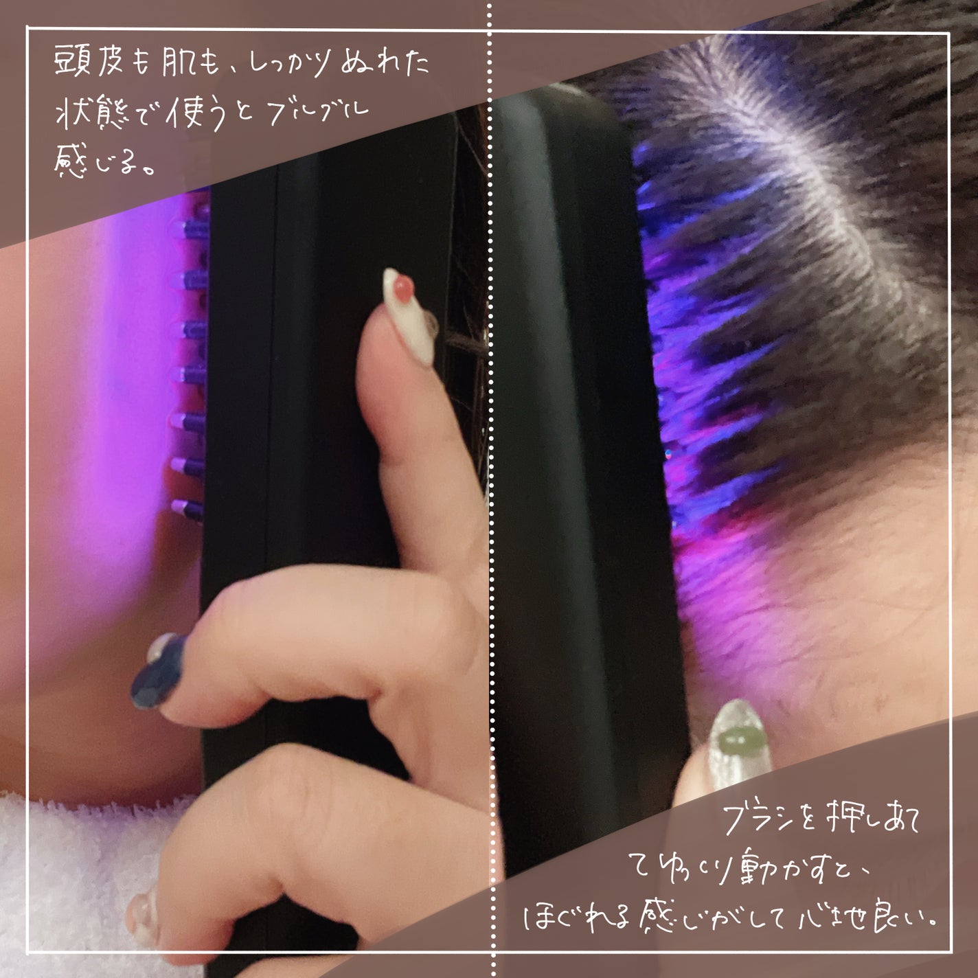 エレキブラシ/Brighte/美顔器・マッサージを使ったクチコミ(4枚目)