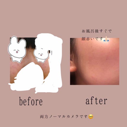 ハトムギ化粧水(ナチュリエ スキンコンディショナー R )/ナチュリエ/化粧水を使ったクチコミ(2枚目)