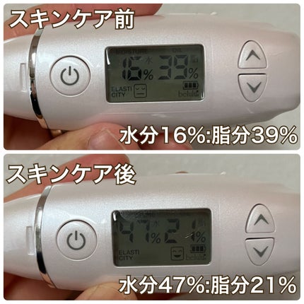 美ルル スキンチェッカー/belulu/美顔器・マッサージを使ったクチコミ(2枚目)