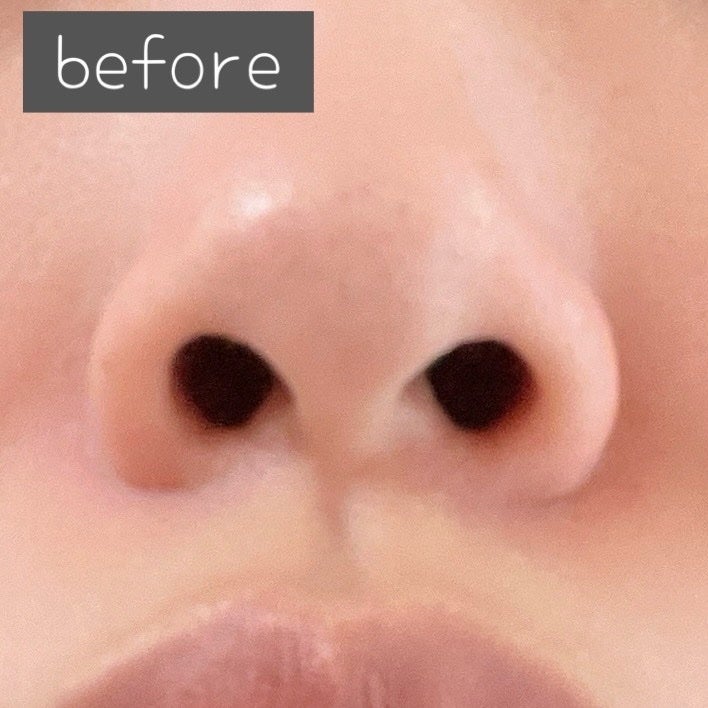 Fornez(フォーネス)/LUXCEAR/美顔器・マッサージを使ったクチコミ(5枚目)