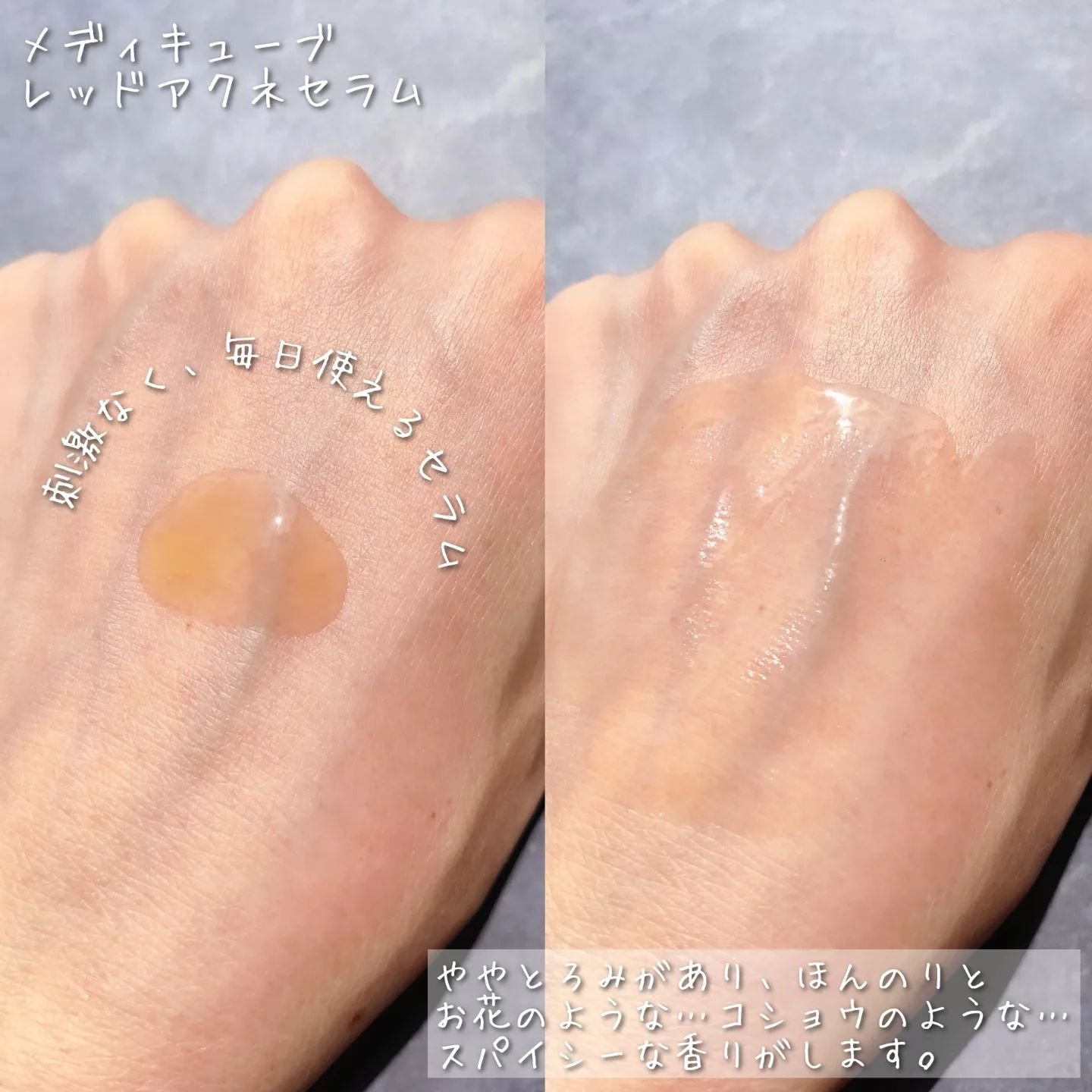 レッドアクネピーリングセラム/MEDICUBE/美容液を使ったクチコミ（3枚目）