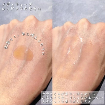 レッドアクネピーリングセラム/MEDICUBE/美容液を使ったクチコミ(3枚目)