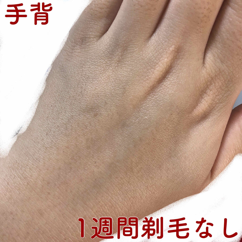 Richesse9 IPL光脱毛器/Richesse9(リシェスナイン)/家庭用脱毛器を使ったクチコミ（3枚目）