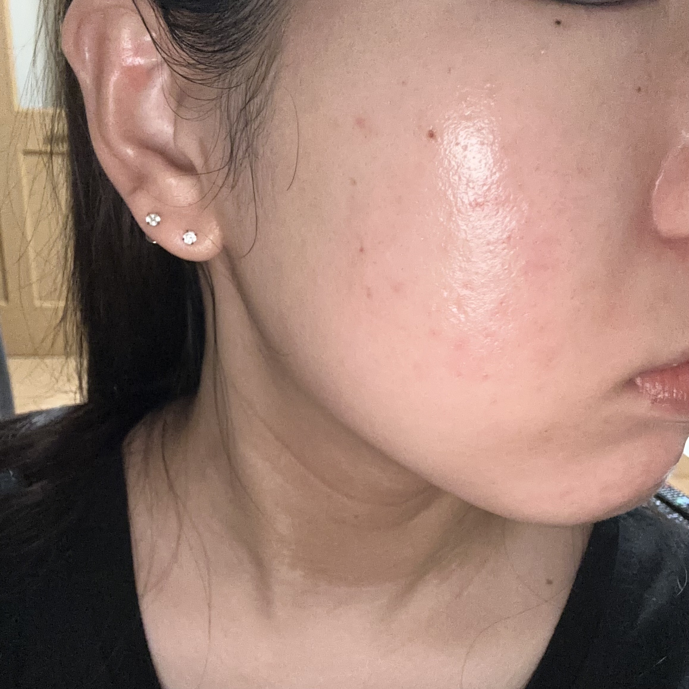 潤浸保湿 乳液/キュレル/乳液を使ったクチコミ（2枚目）