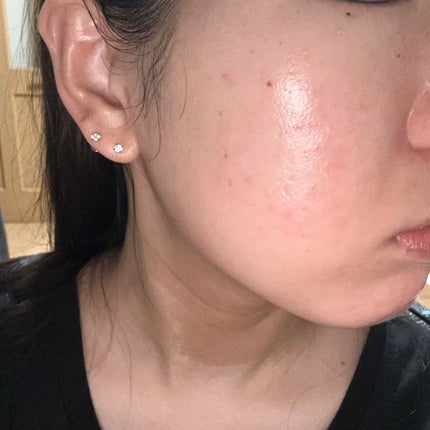 潤浸保湿 化粧水 III とてもしっとり/キュレル/化粧水を使ったクチコミ(2枚目)