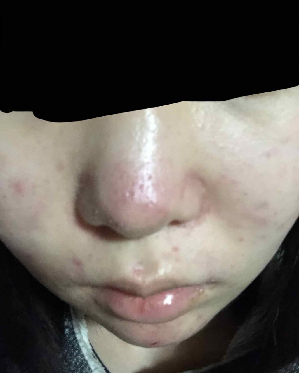 薬用 しみ 集中対策 美容液/メラノCC/美容液を使ったクチコミ(2枚目)