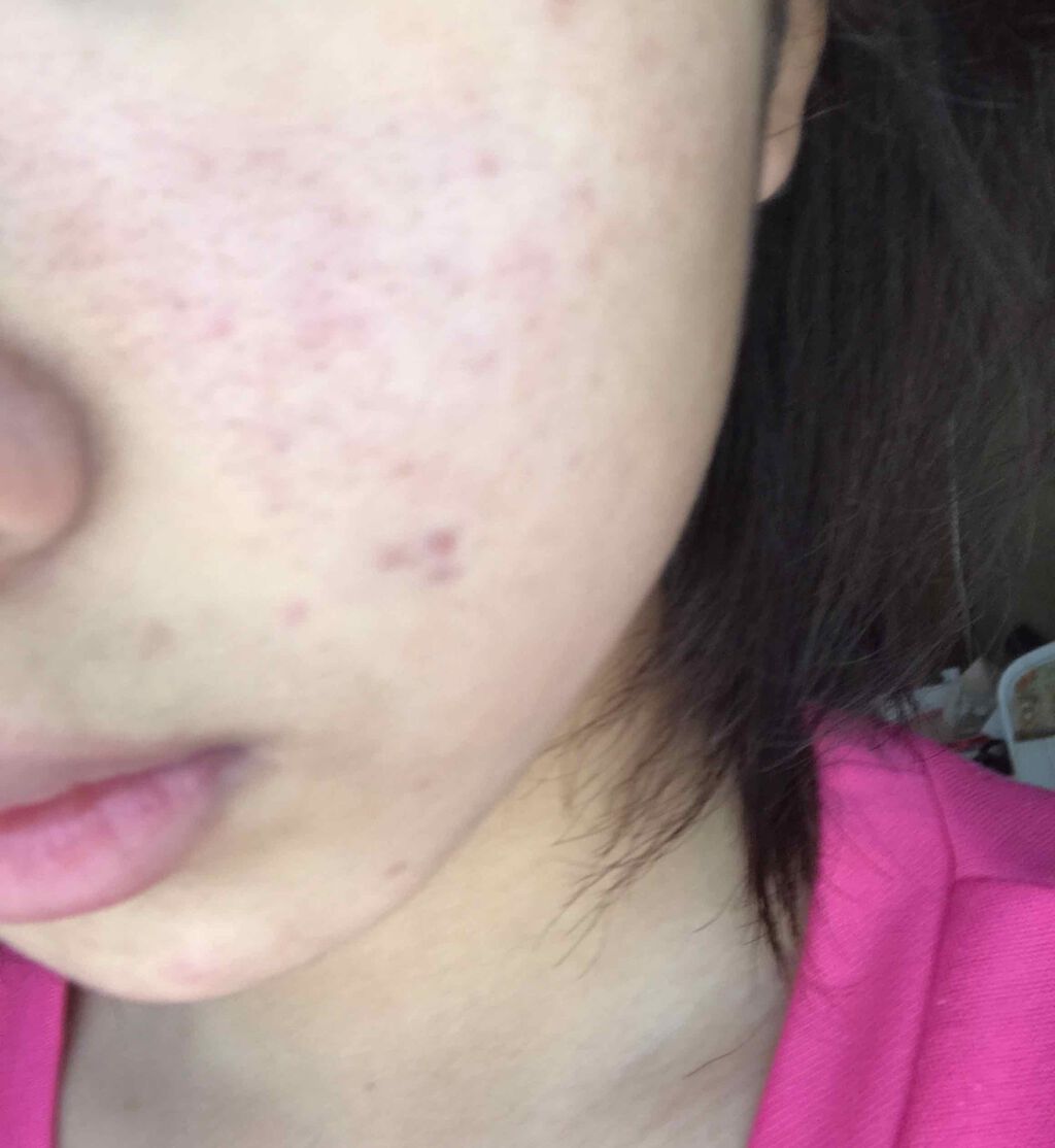 スキンケア洗顔料 オイルコントロール/ビオレ/洗顔フォームを使ったクチコミ（2枚目）