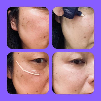 Wエッセンス/shimaboshi/美容液を使ったクチコミ(9枚目)