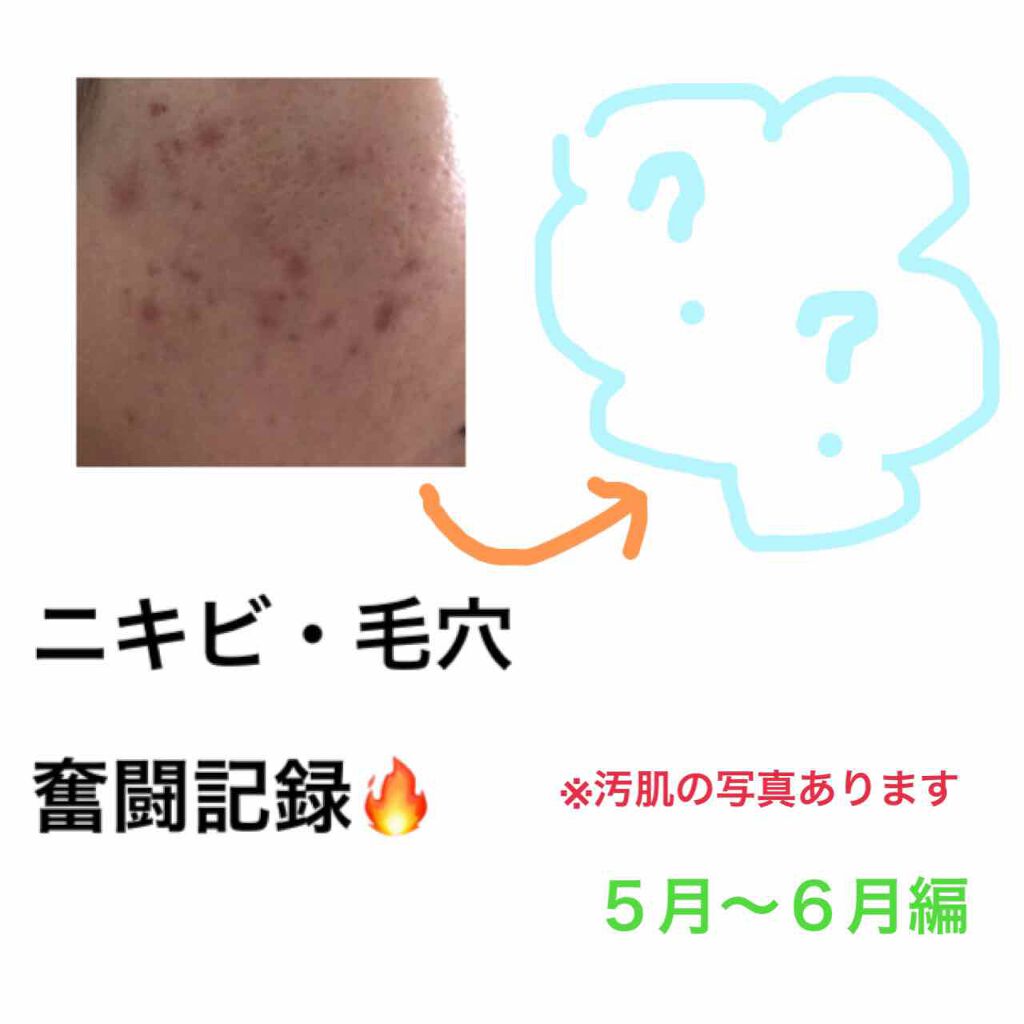 デュオ ザ クレンジングバーム クリア/DUO/クレンジングバームを使ったクチコミ(1枚目)