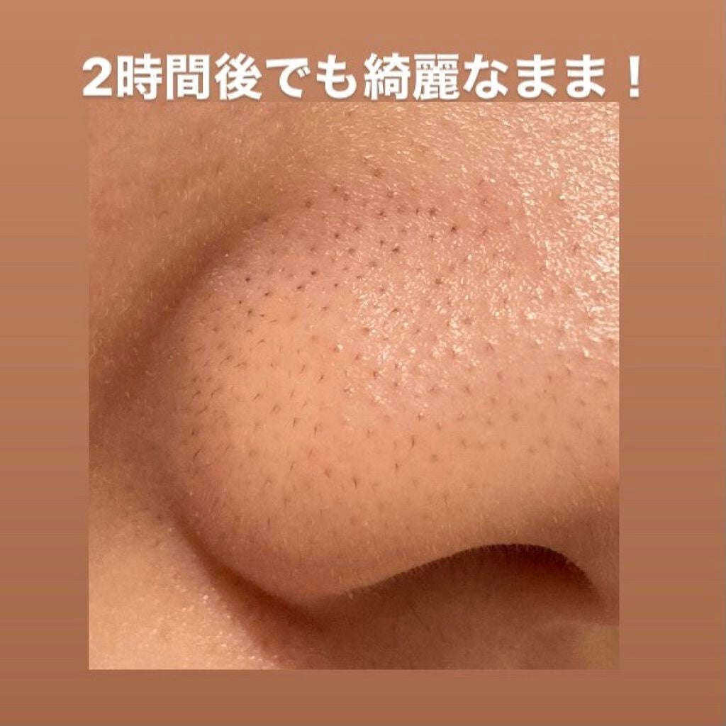 DETクリア ブライト&ピール ピーリングジェリー<無香料タイプ>/Detclear/ピーリングを使ったクチコミ(3枚目)