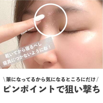 スポットパウダーエッセンス/ポツント/美容液を使ったクチコミ(4枚目)