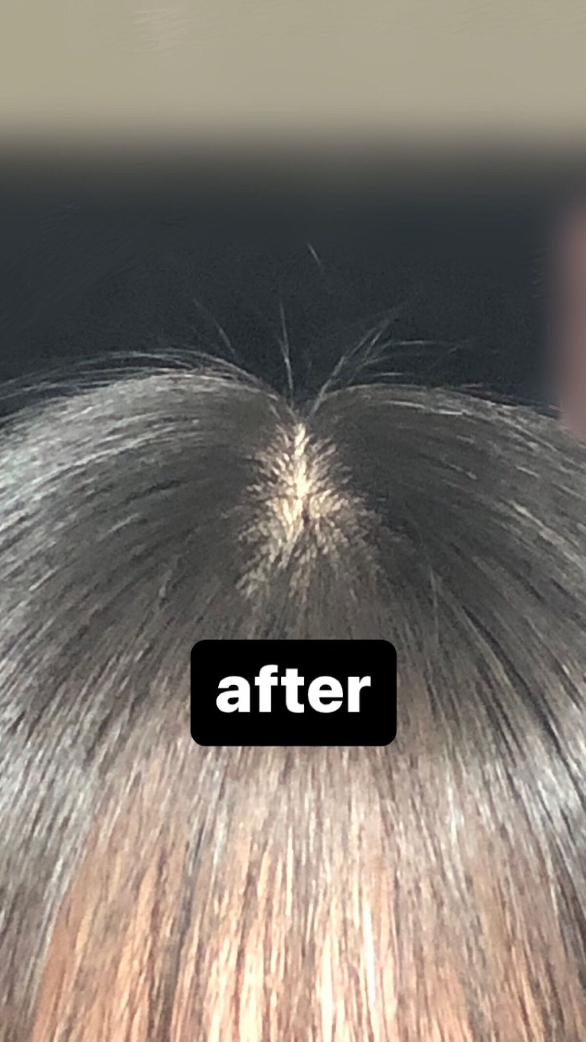 ツナ on LIPS 「「ファイバープレックストリートメントn」週一の特別ケアに使う、..」(2枚目)