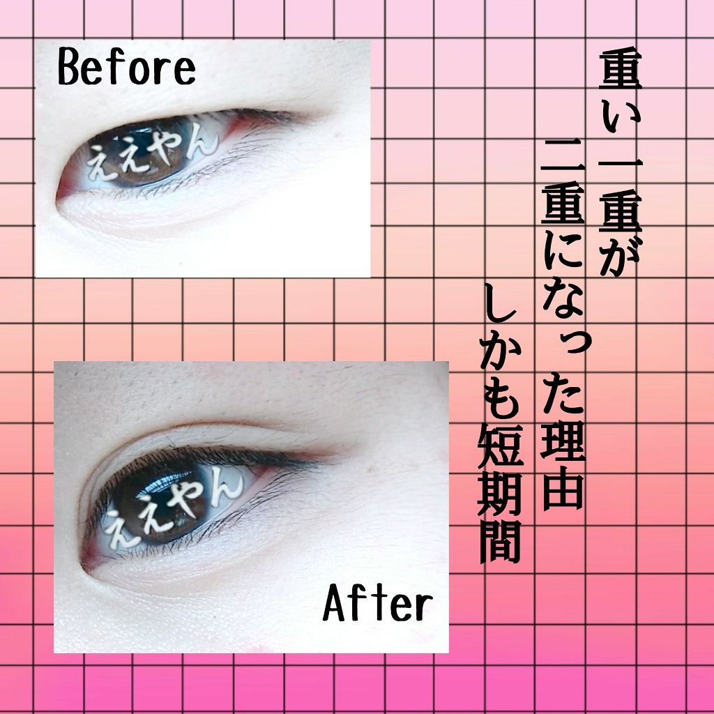 アイトーク/アイトーク/二重まぶた用アイテムを使ったクチコミ(1枚目)