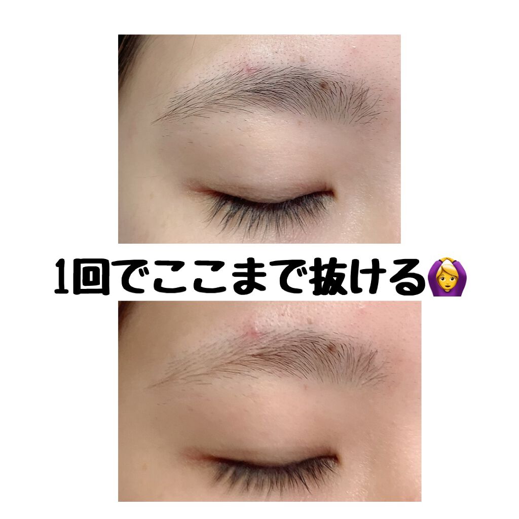 脱色クリーム スピーディー/エピラット/ムダ毛ケアを使ったクチコミ(4枚目)