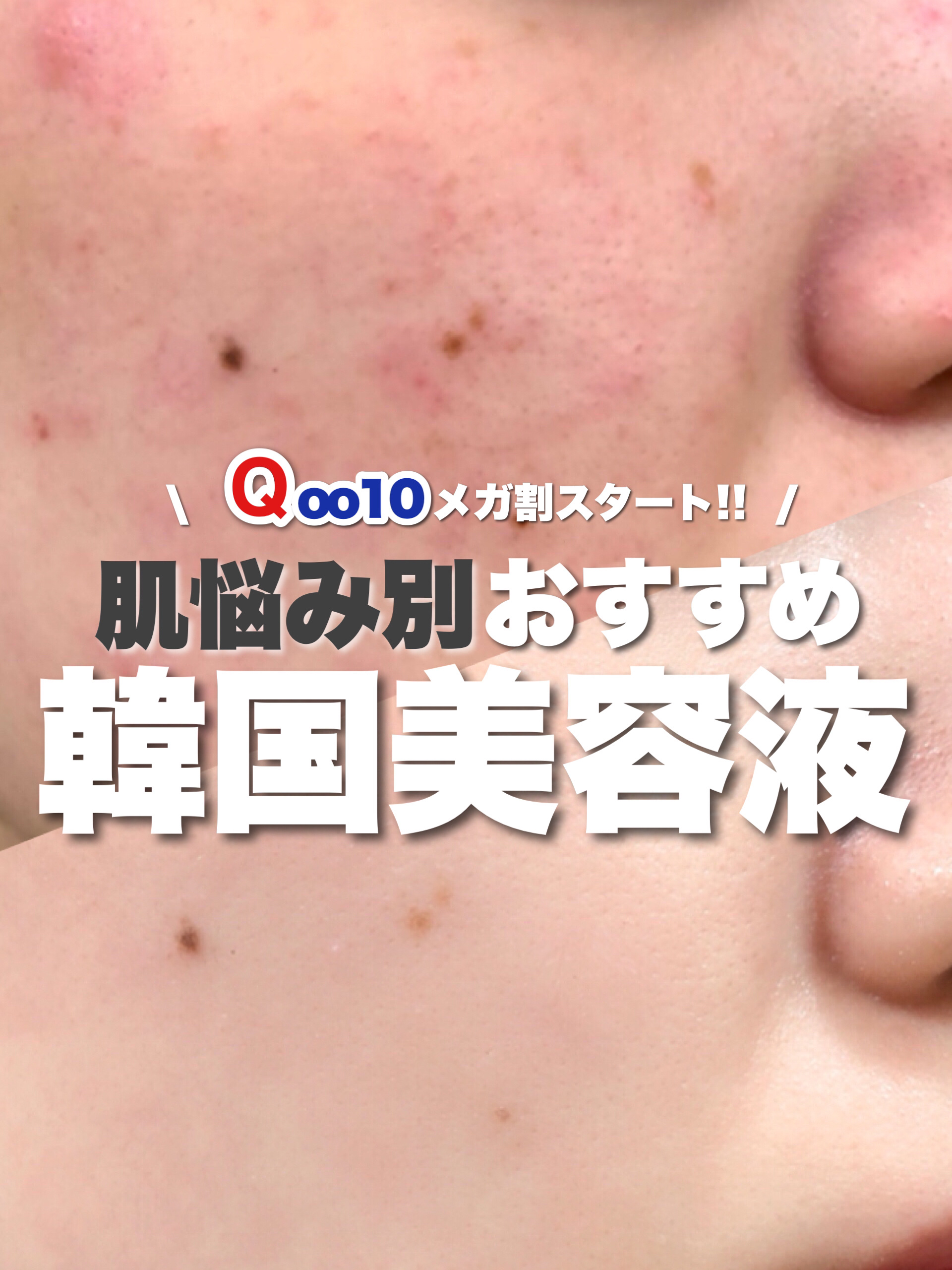 Noni Ampule/celimax/美容液を使ったクチコミ（1枚目）