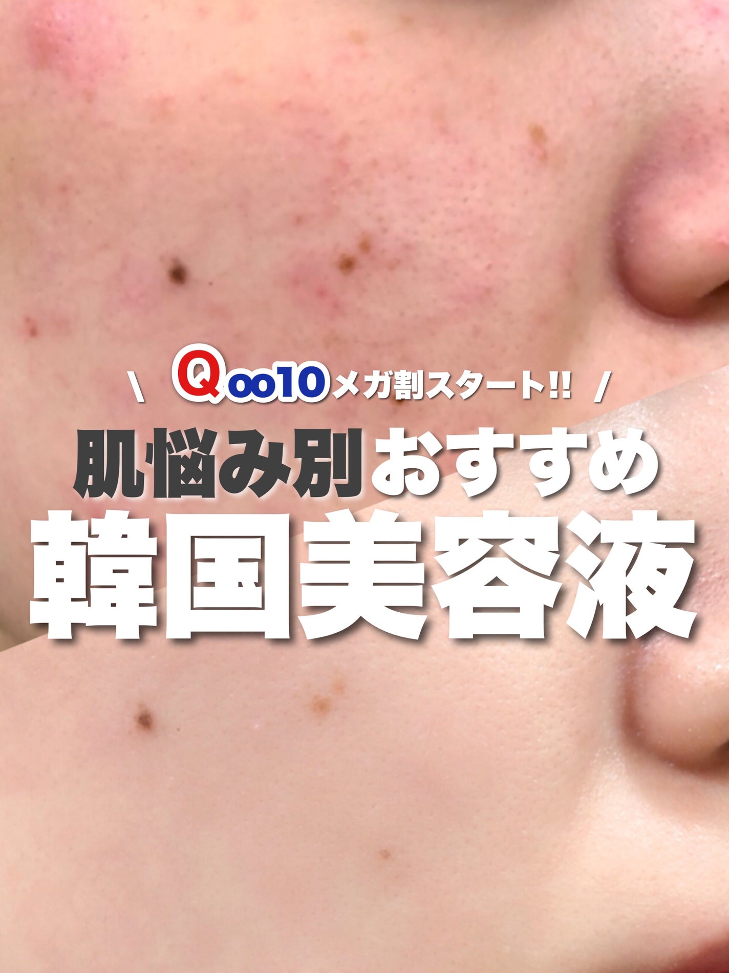 Noni Ampule/celimax/美容液を使ったクチコミ(1枚目)