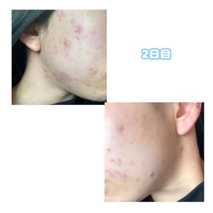 敏感肌用薬用美白美容液/無印良品/美容液を使ったクチコミ(3枚目)