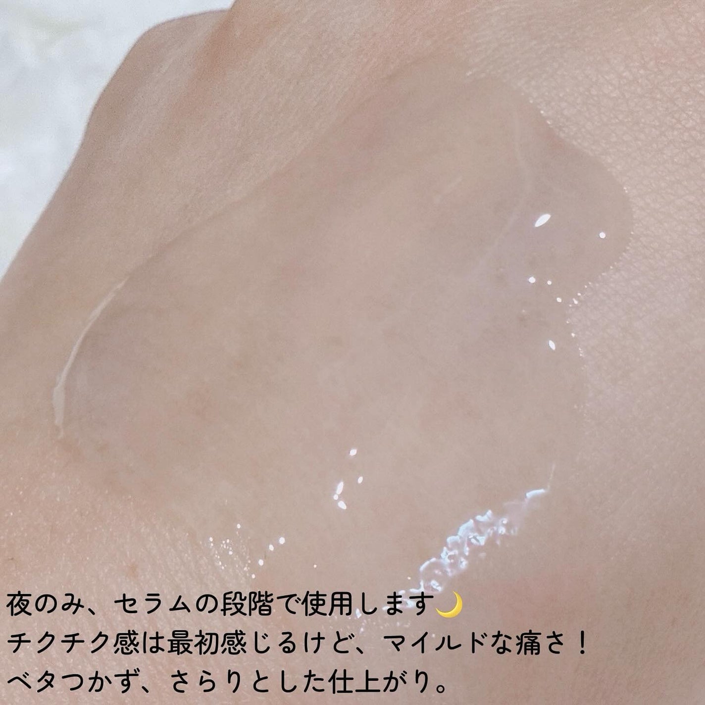 ニードルセラムAZ/fractionalCC/美容液を使ったクチコミ(4枚目)