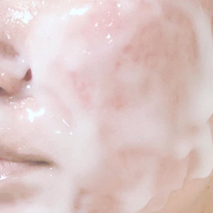 高濃度炭酸パック/17skin/シートマスク・パックを使ったクチコミ(4枚目)