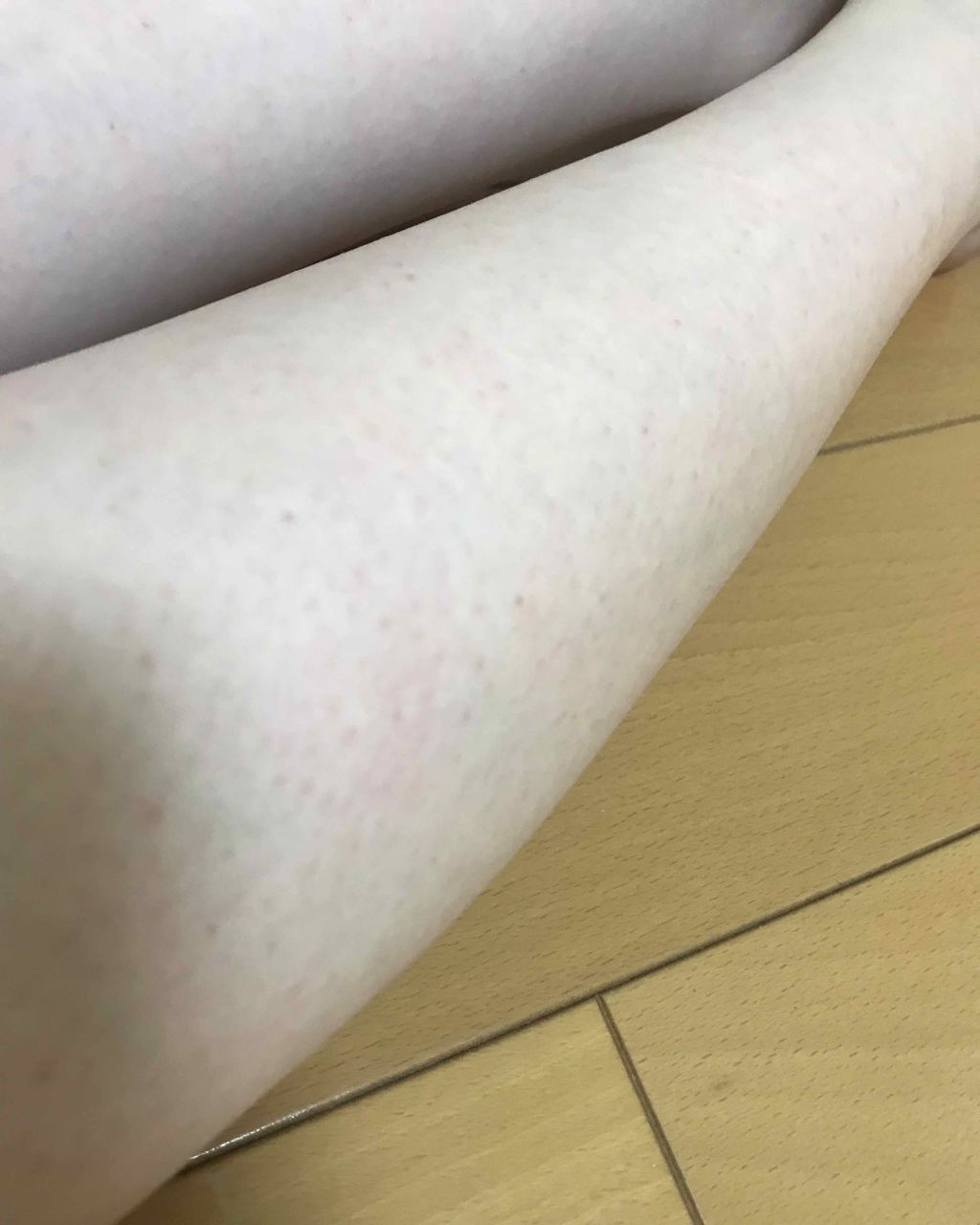 ケアノキュア(医薬品)/小林製薬/その他を使ったクチコミ(3枚目)