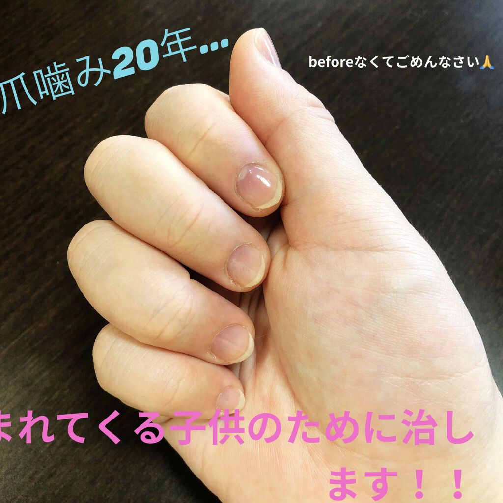 ディーアップファンデーション/D-UP/ネイルベースコートを使ったクチコミ（1枚目）