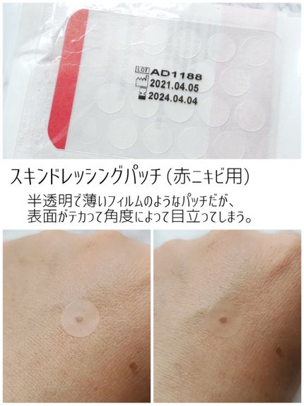 A-zero Shot Trouble Dressing Spot Patch/MEDIHEAL/シートマスク・パックを使ったクチコミ(5枚目)