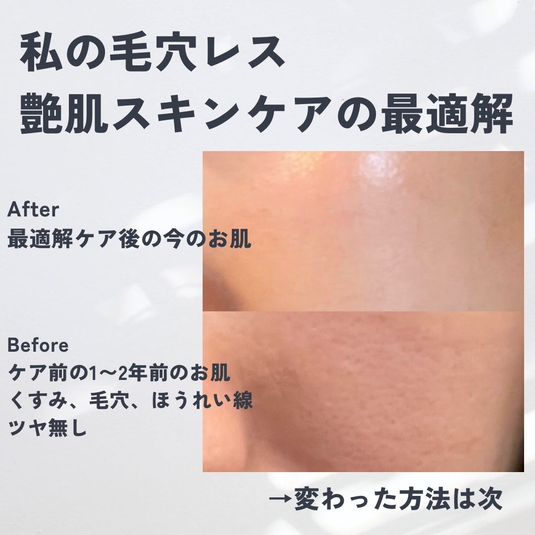 オバジX リフトローション/オバジ/化粧水を使ったクチコミ(1枚目)