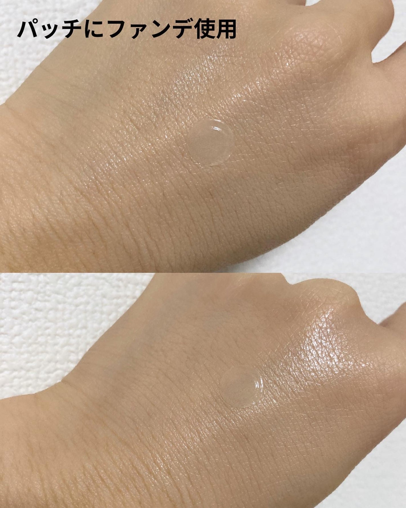 ビューティー スポットパッチ/イージーダムビューティー/にきびパッチを使ったクチコミ(5枚目)