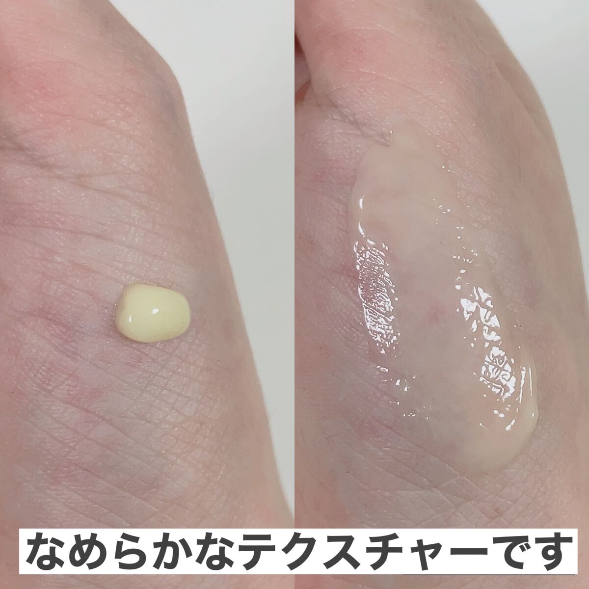 ヴィーガンリポソームレチノールセラム/SKIN&LAB/美容液を使ったクチコミ（3枚目）