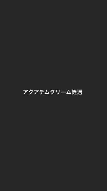 アクアチムローション、アクアチムクリーム(医薬品)/大塚製薬/その他スキンケアを使ったクチコミ（1枚目）