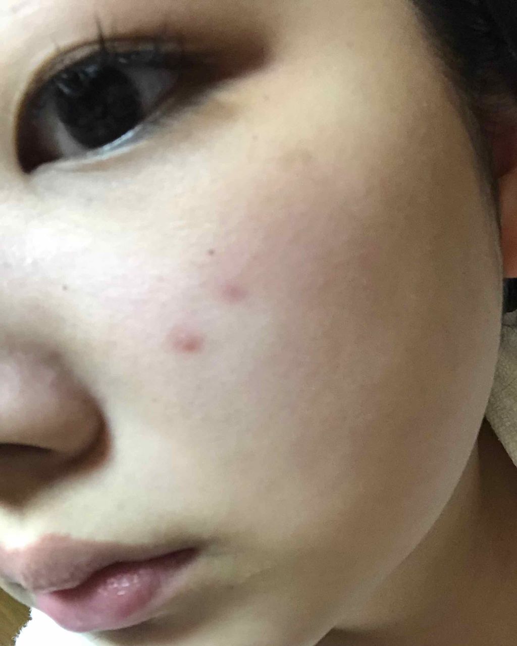 メラノCC 薬用しみ集中対策液(旧)/メラノCC/美容液を使ったクチコミ(4枚目)