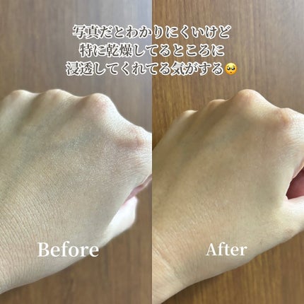 エクソソームミストローション/soarsome/ミスト状化粧水を使ったクチコミ(4枚目)