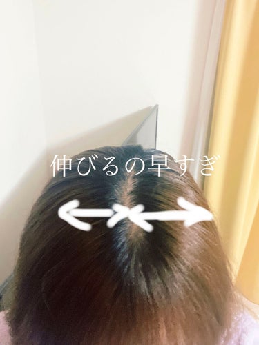 ヘアアクセルレーターEX/加美乃素本舗/頭皮ケアを使ったクチコミ（1枚目）