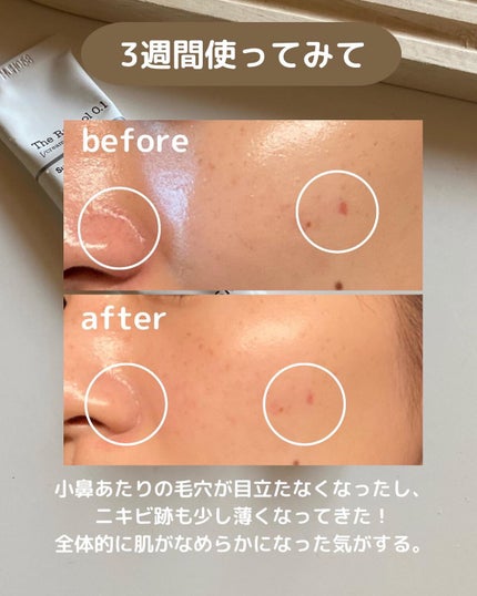 RXザ・レチノール0.1クリーム/COSRX/フェイスクリームを使ったクチコミ(4枚目)