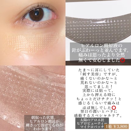 ヒアロビューティーマイクロパッチ/太陽のアロエ社/シートマスク・パックを使ったクチコミ(2枚目)