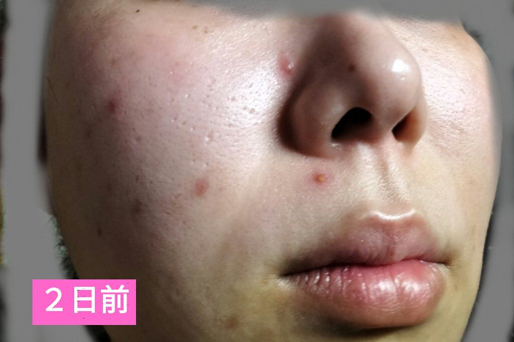 ピュア　ナチュラル　エッセンスローション　リフト　/pdc/オールインワン化粧品を使ったクチコミ（2枚目）