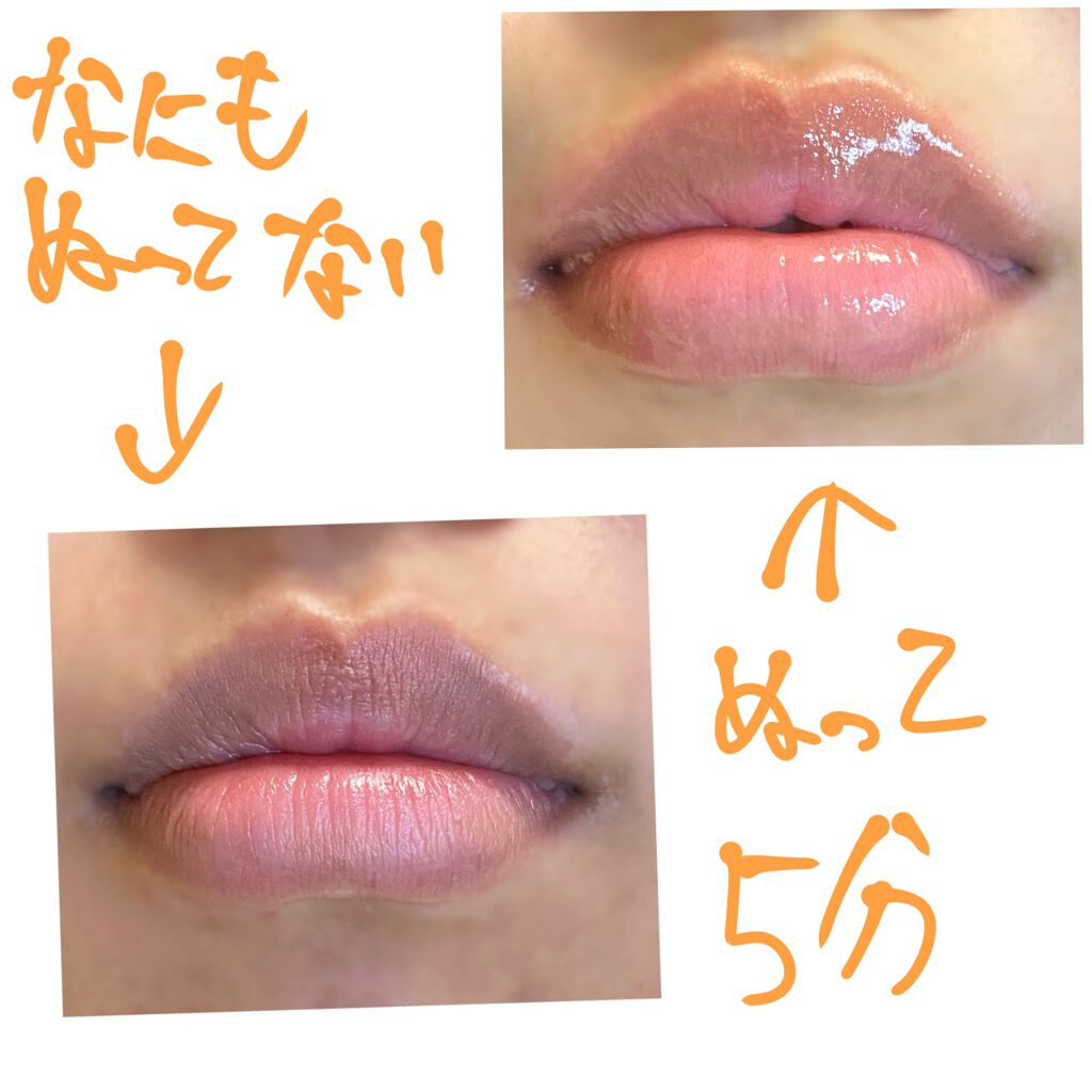 ドトムリッププラスプランパー/keybo/リッププランパーを使ったクチコミ(2枚目)
